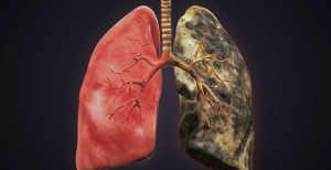 Suitsetamise mõju hingamisteedele